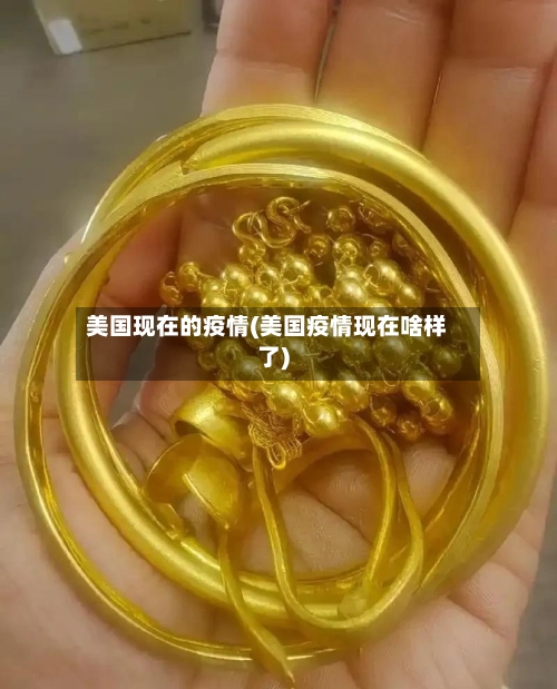 美国现在的疫情(美国疫情现在啥样了)-第2张图片