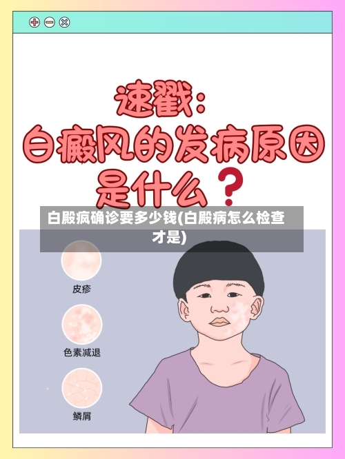 白殿疯确诊要多少钱(白殿病怎么检查才是)