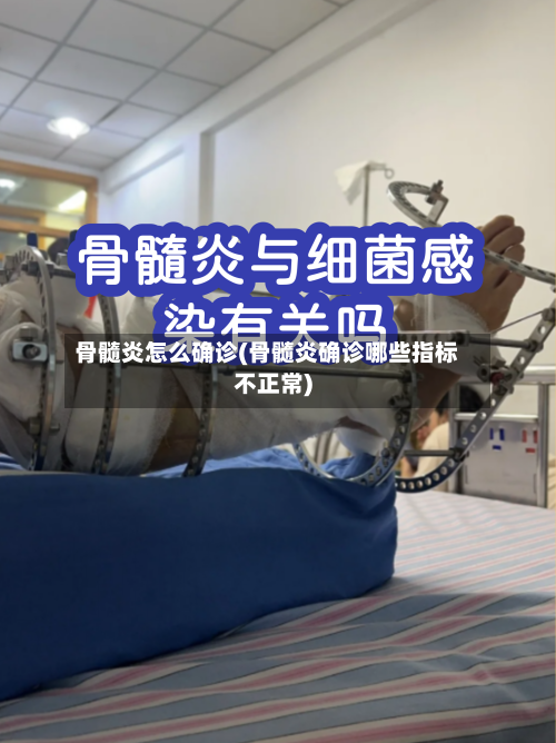 骨髓炎怎么确诊(骨髓炎确诊哪些指标不正常)