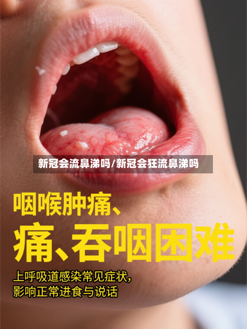 新冠会流鼻涕吗/新冠会狂流鼻涕吗