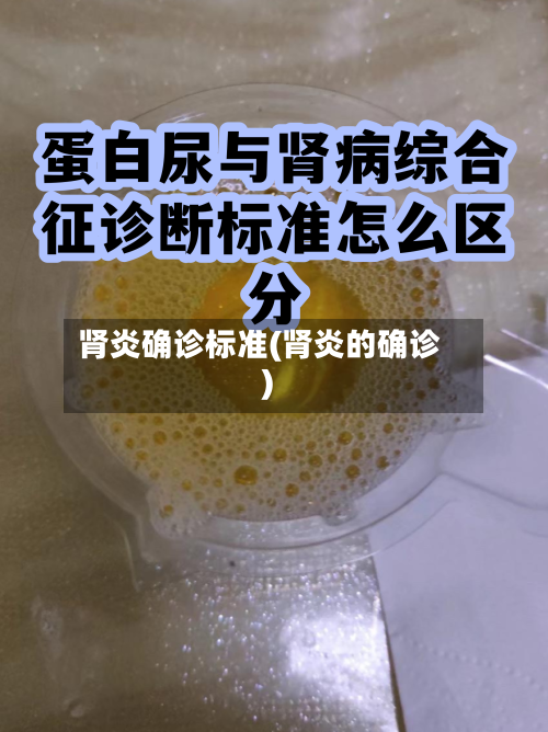 肾炎确诊标准(肾炎的确诊)-第3张图片
